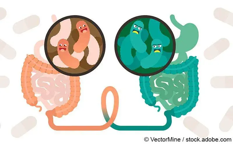 Faekale Mikrotransplantation