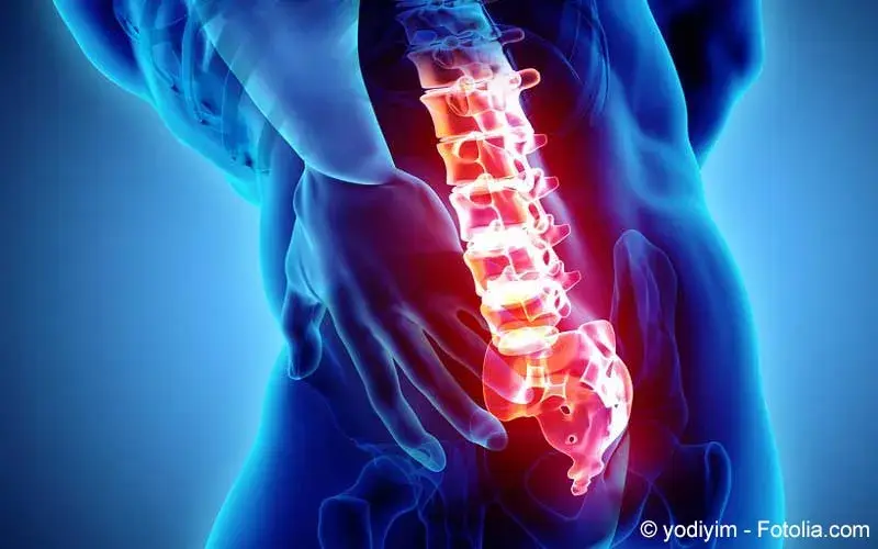 Rueckenschmerzen