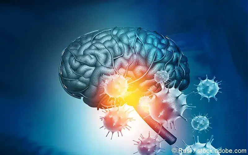 Virusinfektion Gehirn