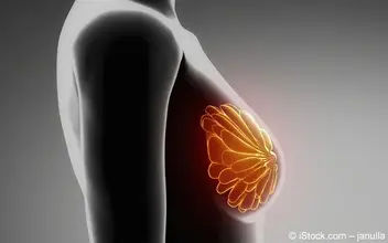 Brust-Drüsengewebe-stilisiert Brust-Drüsengewebe-stilisiert