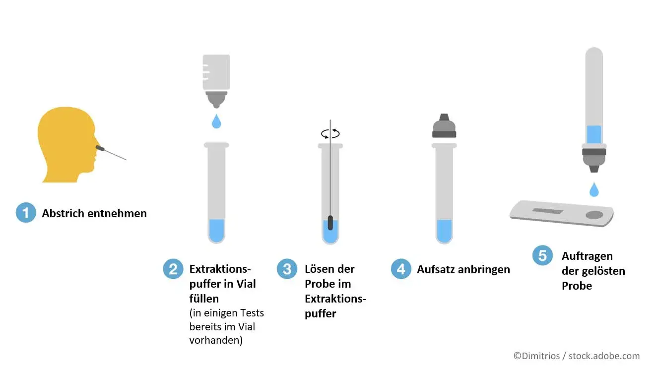 Anleitung Selbsttest