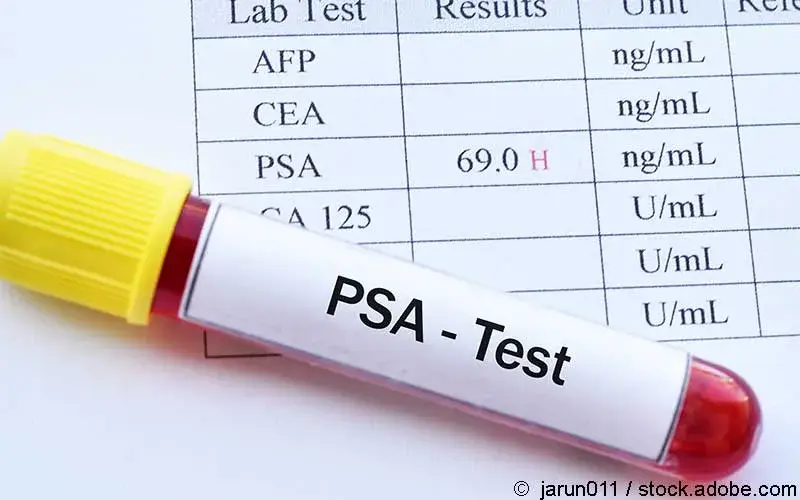 PSA-Test