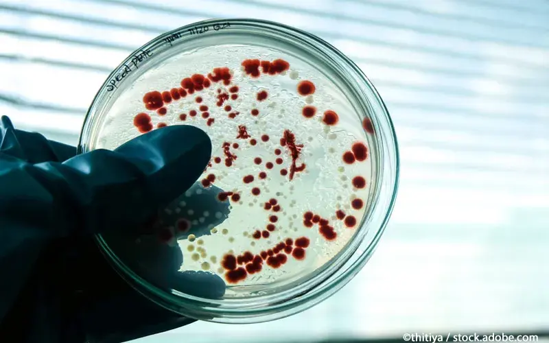 Petrischale Bakterien