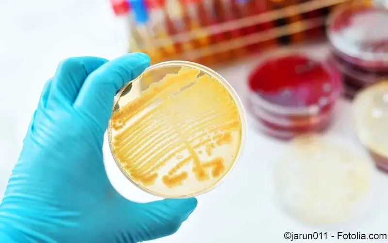 Petrischale mit Erregern