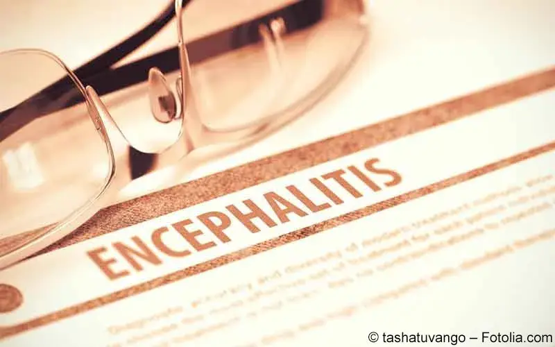 Encephalitis