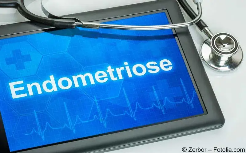 Endometriose