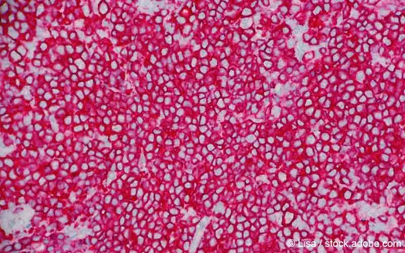 Follikulaeres Lymphom