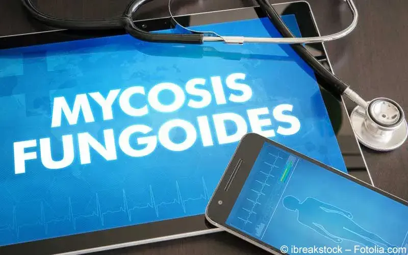 Mycosis Fungoides