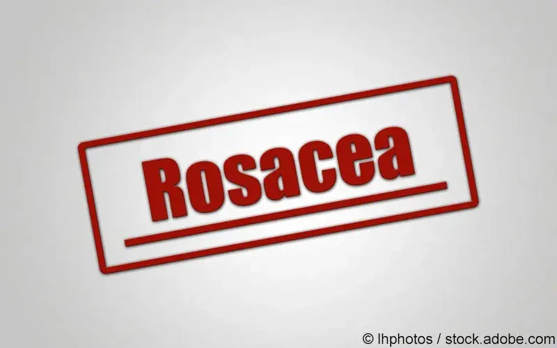 Rosacea Schriftzug