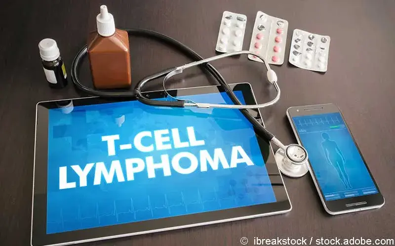 T-Zell-Lymphom