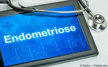 Endometriose Endometriose