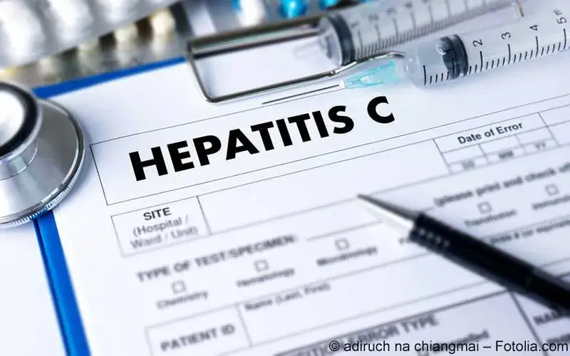 Hepatitis C Hepatitis C