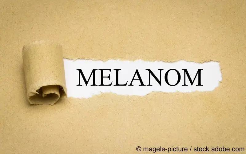 Melanom Schriftzug Melanom Schriftzug