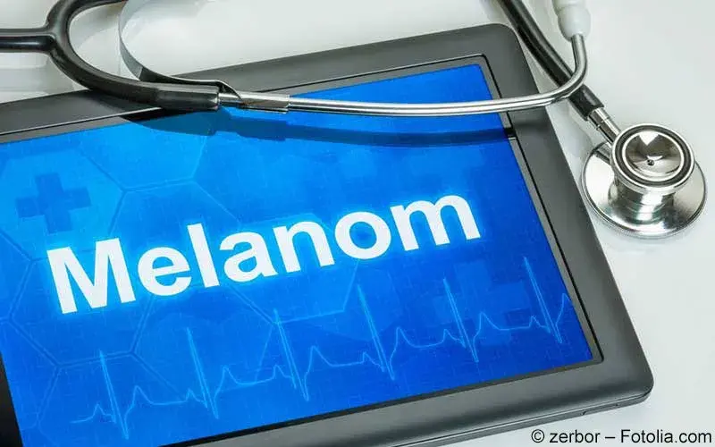 Melanom Melanom