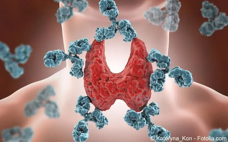 Hashimoto-Thyreoiditis