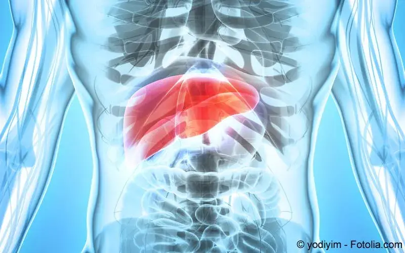 Hepatozelluläres Karzinom