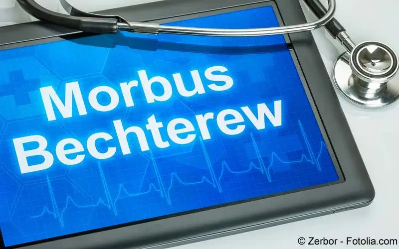 Morbus Bechterew Symptome, Diagnostik, Therapie Gelbe Liste