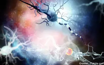 Multiple Sklerose - Neurodegeneration Multiple Sklerose - Neurodegeneration