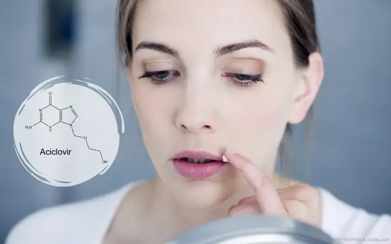Aciclovir-Lippenherpes-Creme