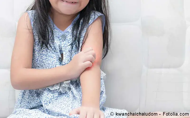 Kind Hautjucken