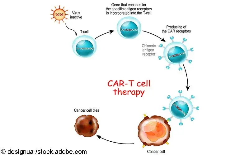 CAR-T-Zelltherapie