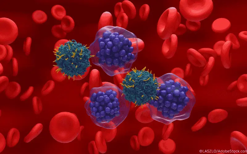 CAR-T_DBCL_B-Zell-Lymphom