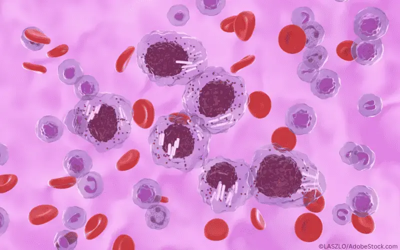chronisch lymphatische leukämie (CLL)