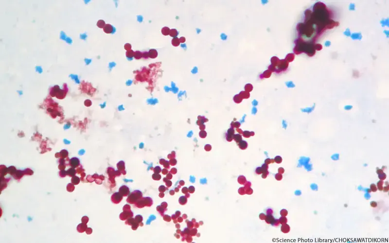 Mycobacterium marinum
