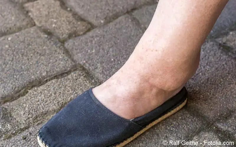Fuß-geschwollen-Frau-Schuh