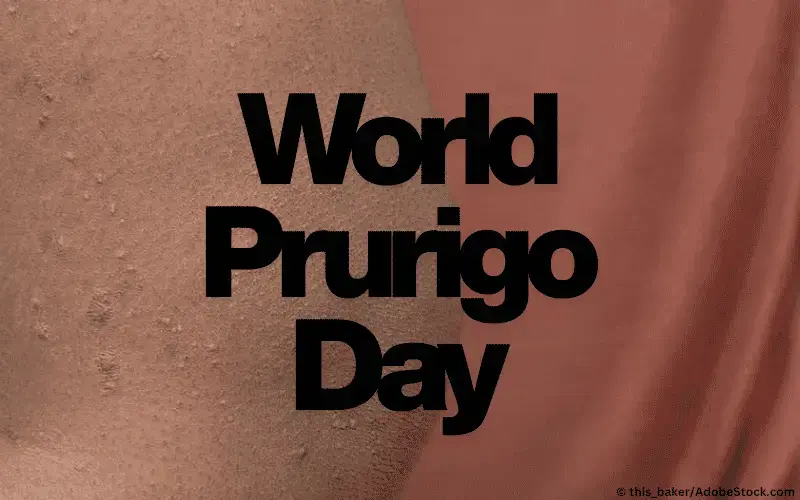 world-prurigo-day-aktionstag