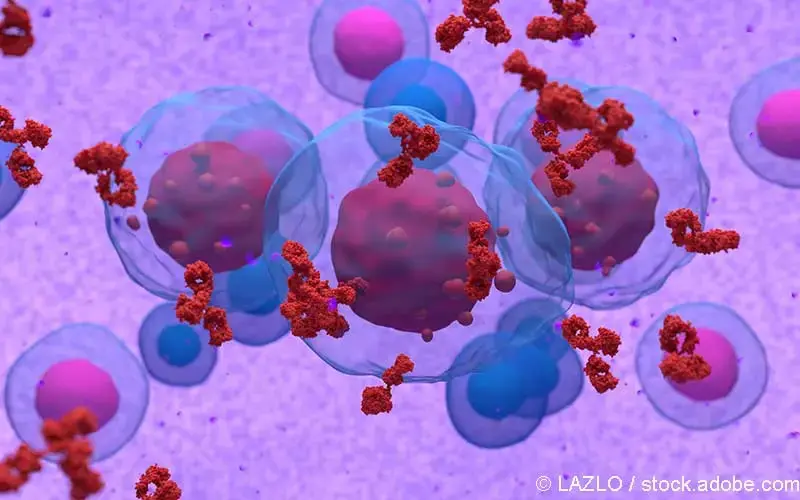 abnorme Zellen Multiples Myelom