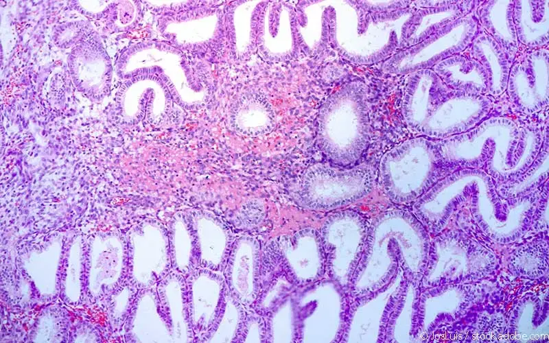Endometrium Schleimhaut