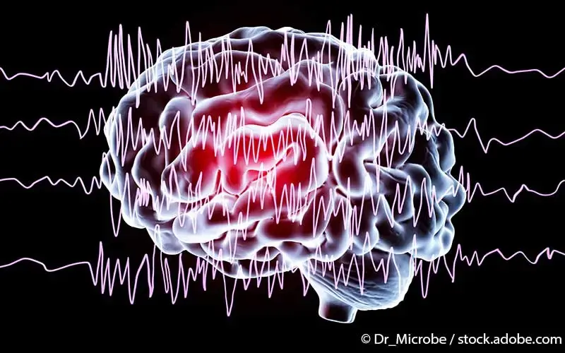 Epilepsie Gehirn
