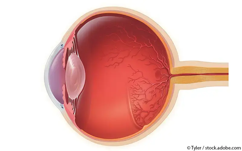 Frühgeborenen-Retinopathie