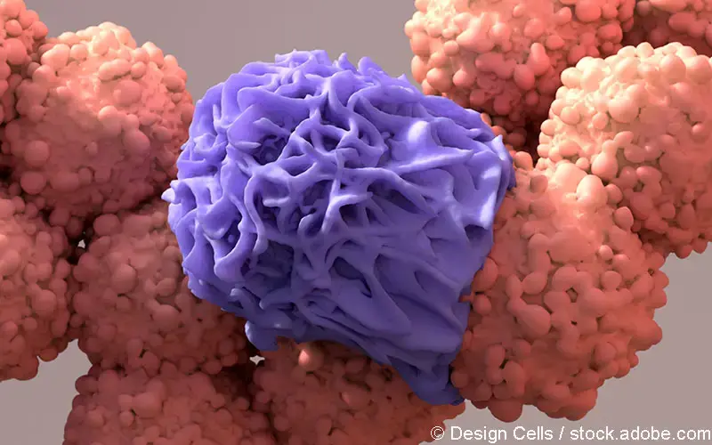 Makrophage-Krebszelle