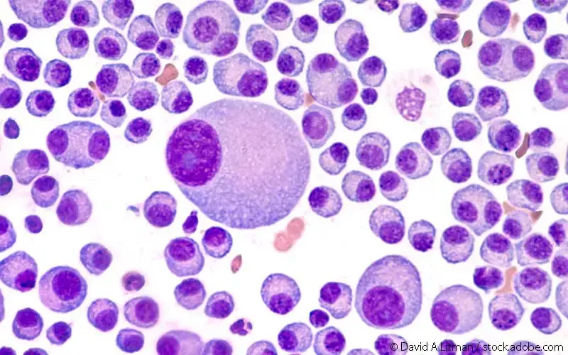 Multiples Myelom Mikroskop