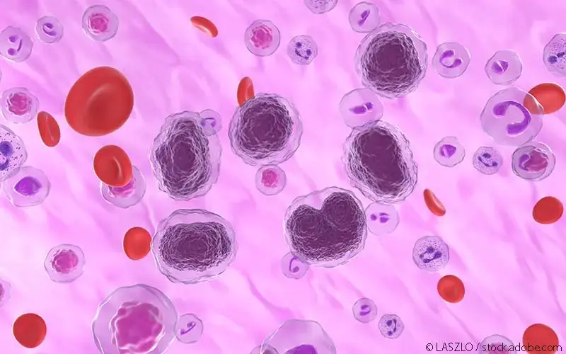 Non-Hodgkin-Lymphom-Zellen