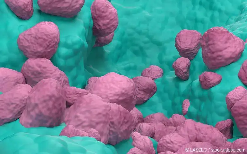 NSCLC 3d 