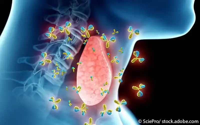 Schilddruese-Antikoerper