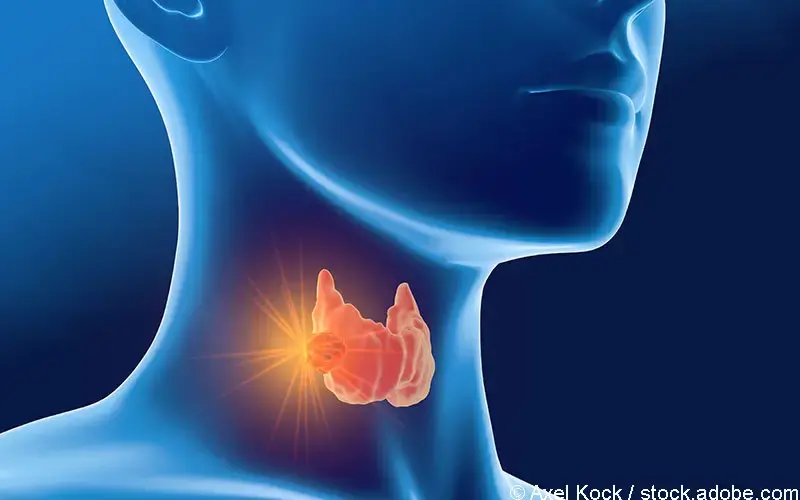 Schilddruesenkarzinom