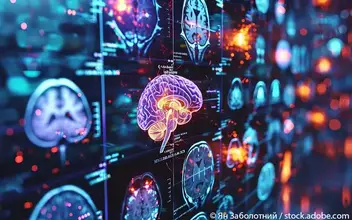 Neurodegeneration Gehirn Neurodegeneration Gehirn