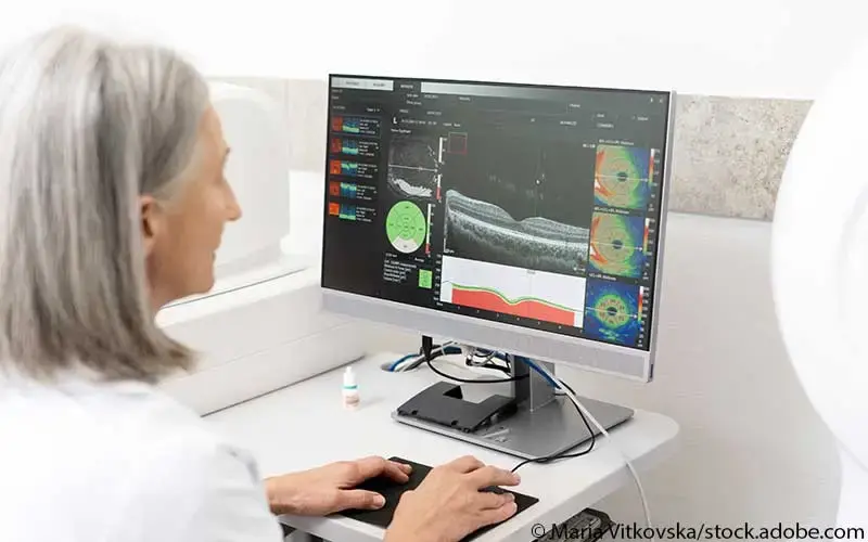 Ärztin wertet OCTA aus