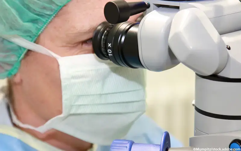 Augenarzt Augenoperation
