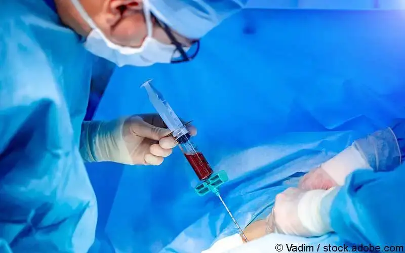 Stammzelltransplantation OP