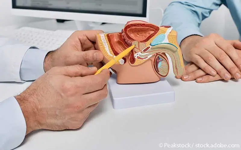 urologe-prostatamodell