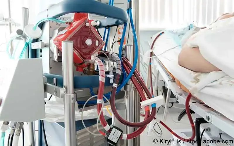 ECMO