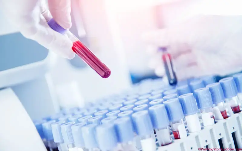 Blutuntersuchung