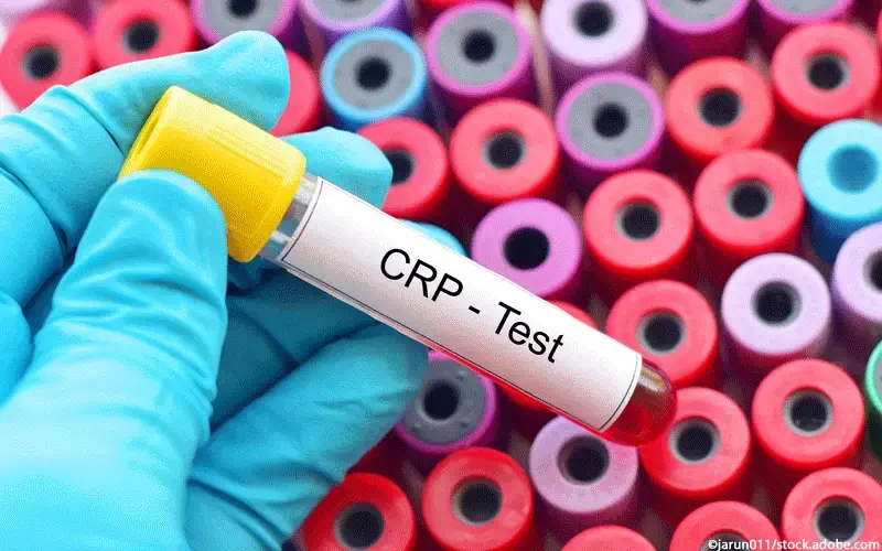 CRP-Test