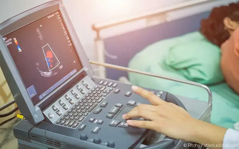 Echokardiographie Untersuchung