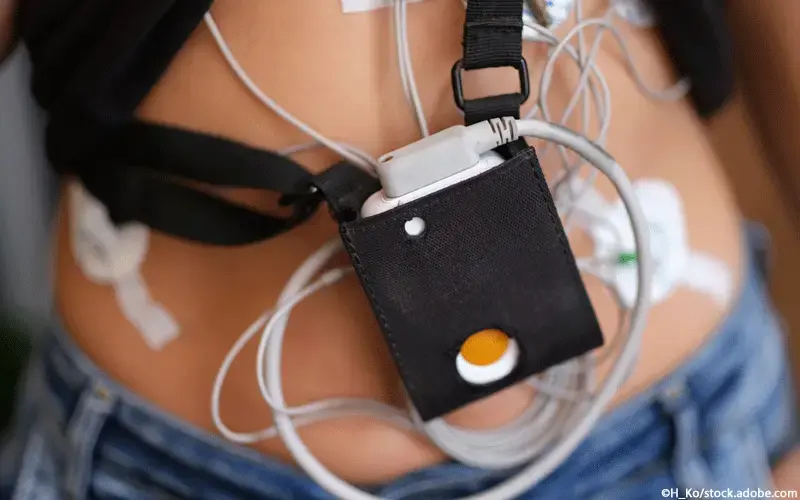 EKG Messgerät tragbar